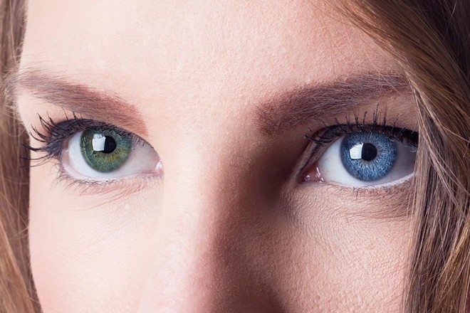  Màu mắt khác nhau là một dấu hiệu nhận biết người nhất thể 