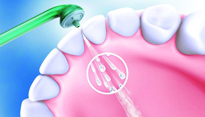  Luồng nước áp lực vừa phải sẽ làm sạch cả phần bọc lợi bao quanh chân răng, loại bỏ mảng bám nơi mà chỉ nha khoa không thể vào tới. 