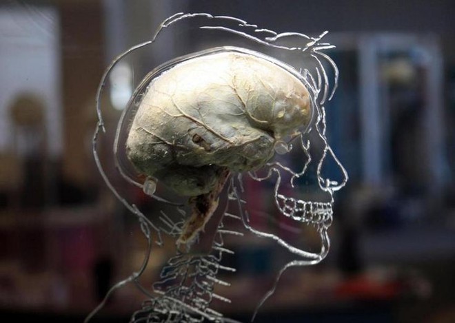 Nếu các nhà khoa học tạo ra được một bộ não, liệu nó sẽ có linh hồn người? - Ảnh 2.