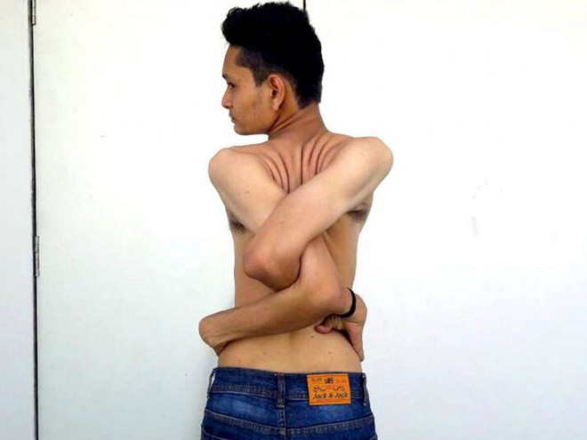 Gặp gỡ chàng trai Ấn Độ có cơ thể uốn dẻo như cao su, uốn vai 360 độ và xoay cổ 180 độ - Ảnh 6.