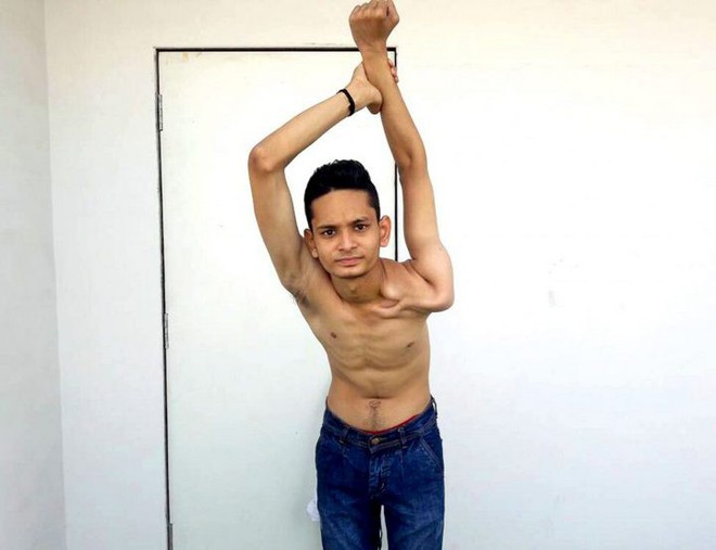 Gặp gỡ chàng trai Ấn Độ có cơ thể uốn dẻo như cao su, uốn vai 360 độ và xoay cổ 180 độ - Ảnh 5.