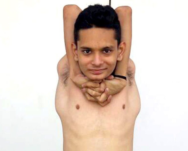 Gặp gỡ chàng trai Ấn Độ có cơ thể uốn dẻo như cao su, uốn vai 360 độ và xoay cổ 180 độ - Ảnh 2.