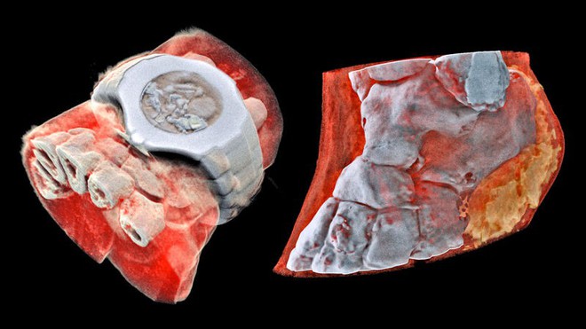Đây là hình ảnh X-quang màu 3D đầu tiên trên thế giới, đừng xem nếu bạn yếu tim - Ảnh 1.
