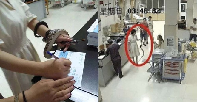 Trung Quốc: Bị cắn nhưng không biết là rắn gì, cô gái bình tĩnh túm cổ nó mang đến bệnh viện - Ảnh 1.