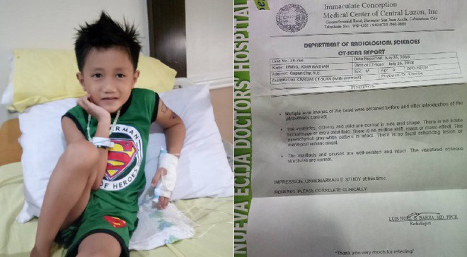 Cậu bé Philippines bị mất kiểm soát cơ mặt, mắt chớp môi rung liên tục sau khi chơi game 9 tiếng/ngày - Ảnh 3.