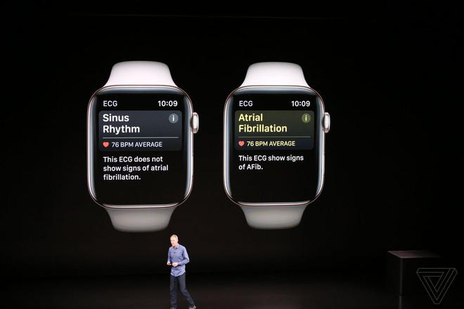 Apple Watch Series 4 ra mắt: Màn hình OLED lớn hơn 35%, hình nền động nhả khói, vẽ điện tâm đồ, phát hiện ngã nhưng pin y như cũ - Ảnh 7.