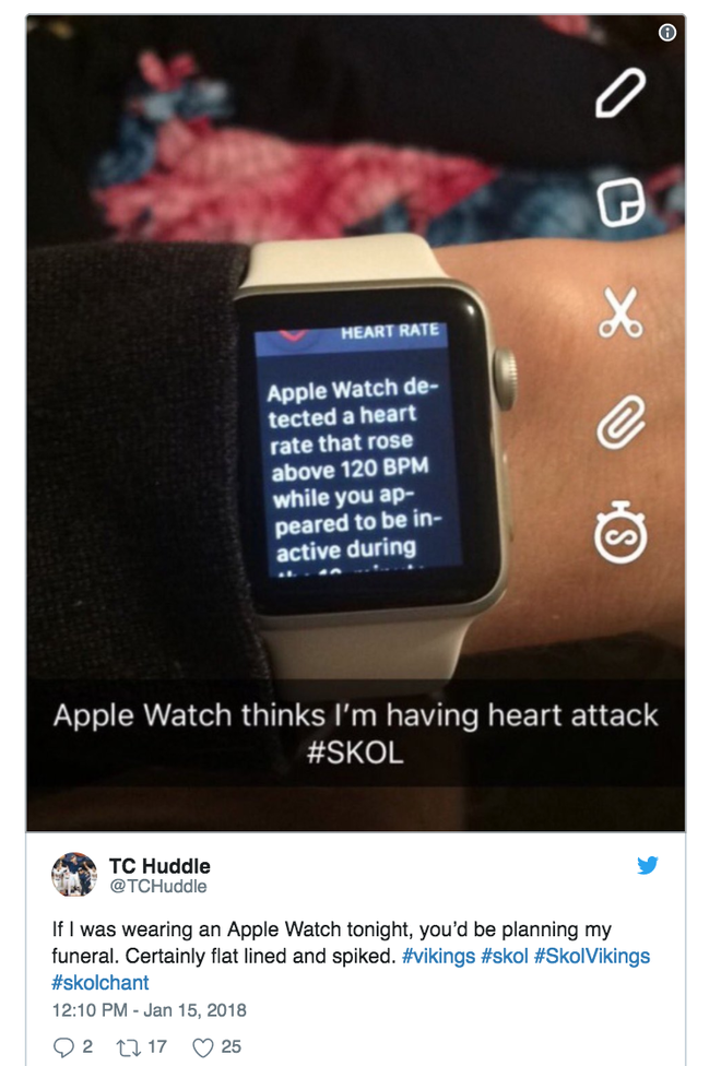  Apple Watch nghĩ là tôi đang bị đau tim 