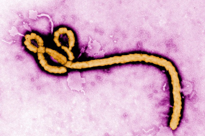 Nghe rất vô lý nhưng lại thuyết phục: Nhật Bản vừa nhập khẩu virus Ebola và 4 mầm bệnh sốt xuất huyết nguy hiểm nhất - Ảnh 1.