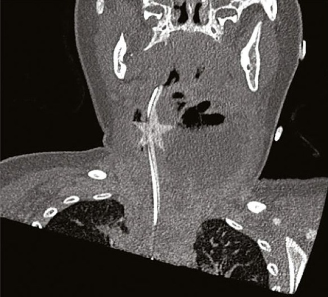 Hiểm họa tiềm t&agrave;ng từ đồ trang tr&iacute; Gi&aacute;ng Sinh: Những ng&ocirc;i sao kim tuyến - Ảnh 2.