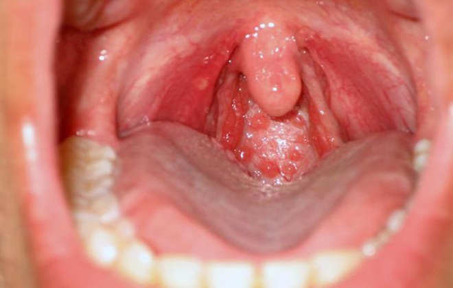 Răng miệng sạch sẽ mà vẫn bị hôi thì bạn nên cân nhắc kiểm tra các bệnh này - Ảnh 1.