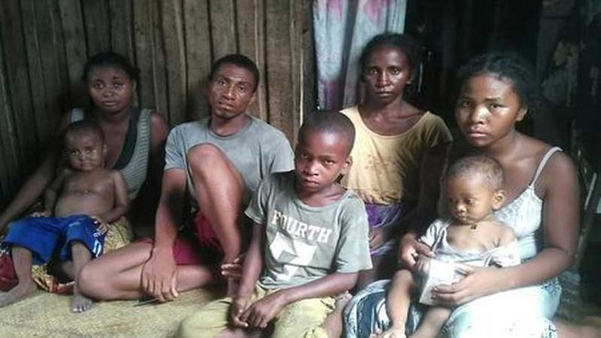 Gần 1.000 trẻ em ở Madagascar chết vì bệnh sởi, người dân không có đủ vắc-xin để tiêm - Ảnh 5.