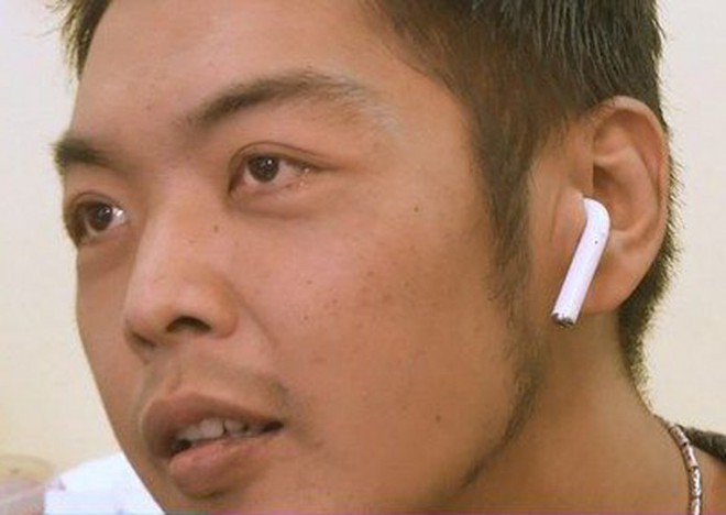 Một anh Đài Loan vô tình nuốt phải tai nghe trong lúc ngủ, sáng dậy thấy nhạc phát ra từ dạ dày - Ảnh 2.