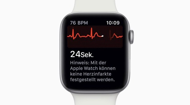 Tính năng đo điện tâm đồ ECG của Apple Watch lại tiếp tục cứu sống mạng người - Ảnh 1.