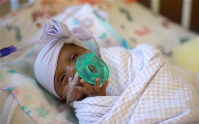 Bé gái nhỏ nhất thế giới được sinh ra ở Mỹ, nặng 245 gam, nhỏ chỉ bằng hộp sữa - Ảnh 2.