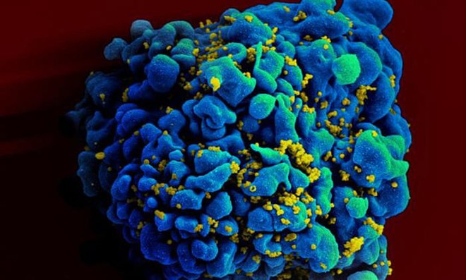 Hồi kết của đại dịch HIV/AIDS đã ở trước mắt: Nghiên cứu xác nhận tỷ lệ truyền nhiễm 0% ở bệnh nhân uống thuốc ARV - Ảnh 1.