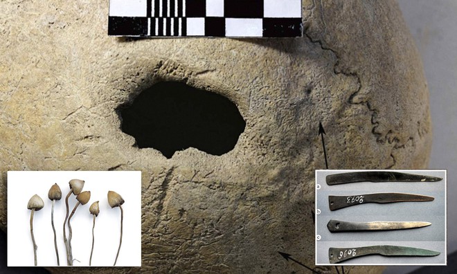 Con người đã thực hiện phẫu thuật sọ trên gia súc từ 5000 năm trước? - Ảnh 3.