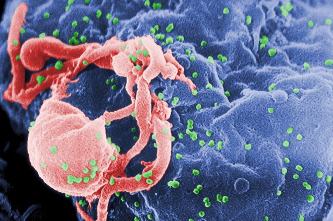 Một bệnh nhân ung thư nhiễm HIV ở Trung Quốc được điều trị bằng tế bào gốc chỉnh sửa gen - Ảnh 1.