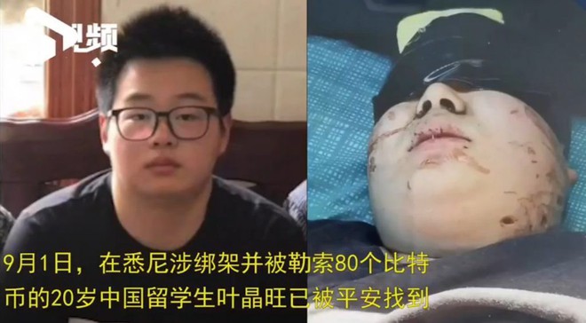 Sinh viên Trung Quốc bị bắt cóc ở Úc được trả tự do sau khi gia đình chuộc bằng 80 bitcoin - Ảnh 3.