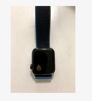 Apple Watch SE gặp lỗi quá nhiệt, khiến người dùng bị bỏng và làm hỏng màn hình - Ảnh 3.