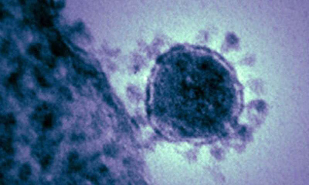 Giải đáp của chuyên gia Harvard: Tại sao các dịch bệnh như virus corona lại giết chết người? Chúng tiến hóa để... tự sát? - Ảnh 2.