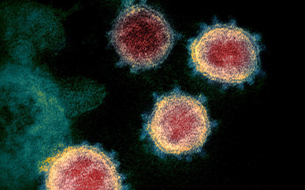  Nghiên cứu mới: Không chỉ phổi, virus SARS-CoV-2 còn có thể làm tổn thương não - Ảnh 1.