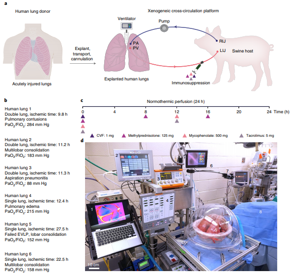Đột phá: Phổi người tổn thương được chữa lành sau 24 giờ nối vào cơ thể lợn - Ảnh 2.
