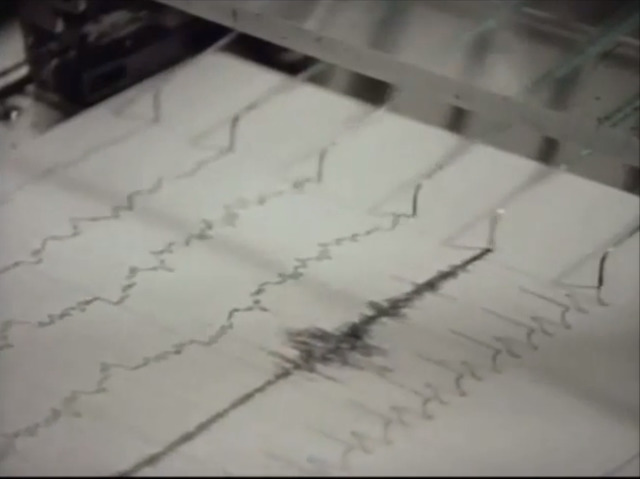 Khi các nghiên cứu và xét nghiệm được tiến hành để chẩn đoán tình trạng của Genie, các nghiên cứu về giấc ngủ cho thấy sóng não của cô bé rất bất thường. Một số nhà nghiên cứu như Shirley nghĩ rằng điều này là do cô bé đã bị tổn thương não ngay sau khi được sinh ra. Tuy nhiên, những người khác như Curtiss đã không chấp nhận quan điểm đó. Trong suốt quá trình nghiên cứu về Genie, cô bé đã cho mọi người thấy được sự cải thiện bởi sự phát triển về thần kinh của trẻ em và người trưởng thành luôn không giống nhau.