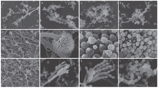 Hình ảnh một số loại vi khuẩn được phát hiện trong tủ lạnh của người dùng.