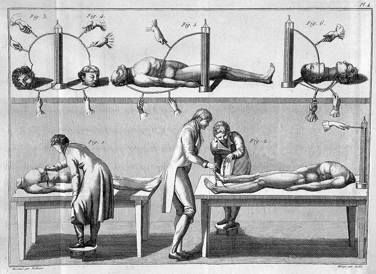 Vào những năm 1800 nhân loại đã cố gắng tạo ra quái vật của Frankenstein ngoài đời thực bằng cách kích điện xác chết - Ảnh 3.