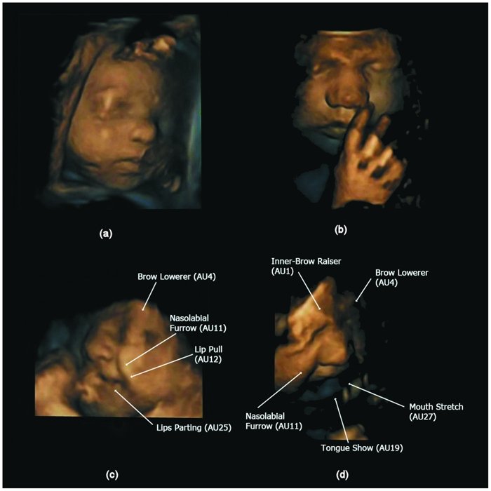 Can a baby cry while still in the womb?  - Photo 2.