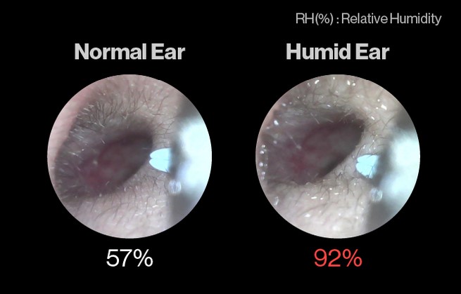 Wearing headphones a lot with itching, pain or a lot of wax has a solution: A dehumidifier for the ears, wearing 3 minutes is dry, buy early to reduce 43% - Photo 1.