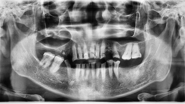  Thời kỳ điên loạn: Từng có người uống nước phóng xạ nhiều đến mức hình dạng không còn nguyên vẹn, nhưng đó lại là chuyện bình thường - Ảnh 3.