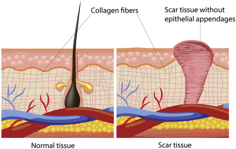 Đột phá: Đây là loại thuốc làm liền sẹo hiệu quả 100%, đến độ cả mắt thường và thuật toán AI đều không phát hiện được - Ảnh 2.