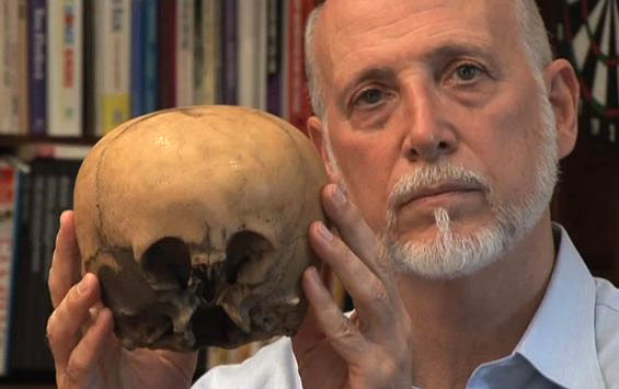 Những hộp sọ kỳ lạ nhất từng được phát hiện trong lịch sử - Ảnh 7.