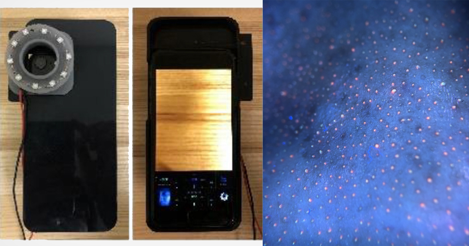 Sử dụng camera trên smartphone để xác định vi khuẩn gây mụn và bệnh răng miệng - Ảnh 1. Sử dụng camera trên smartphone để xác định vi khuẩn gây mụn và bệnh răng miệng - Ảnh 1.