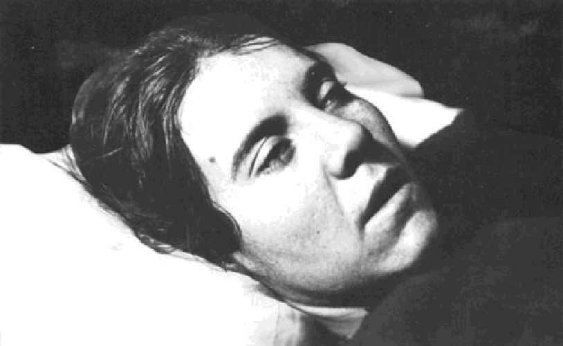 Летаргический энцефалит. Она спала 20 лет. Женщина в маске для сна. Она спала 20 лет. Сон ретро.