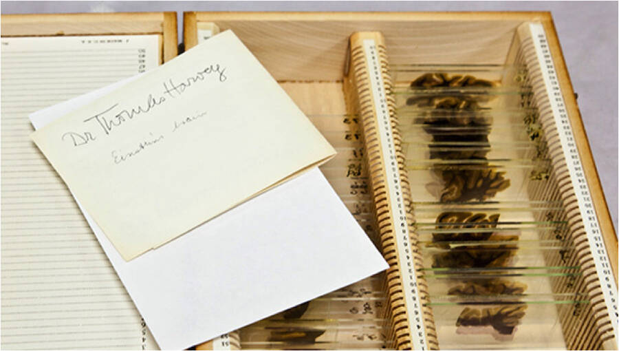 Chuyến phi&ecirc;u lưu của bộ n&atilde;o Albert Einstein, người c&oacute; IQ cao nhất thế giới sau khi n&oacute; bị đ&aacute;nh cắp khỏi cơ thể - Ảnh 6.