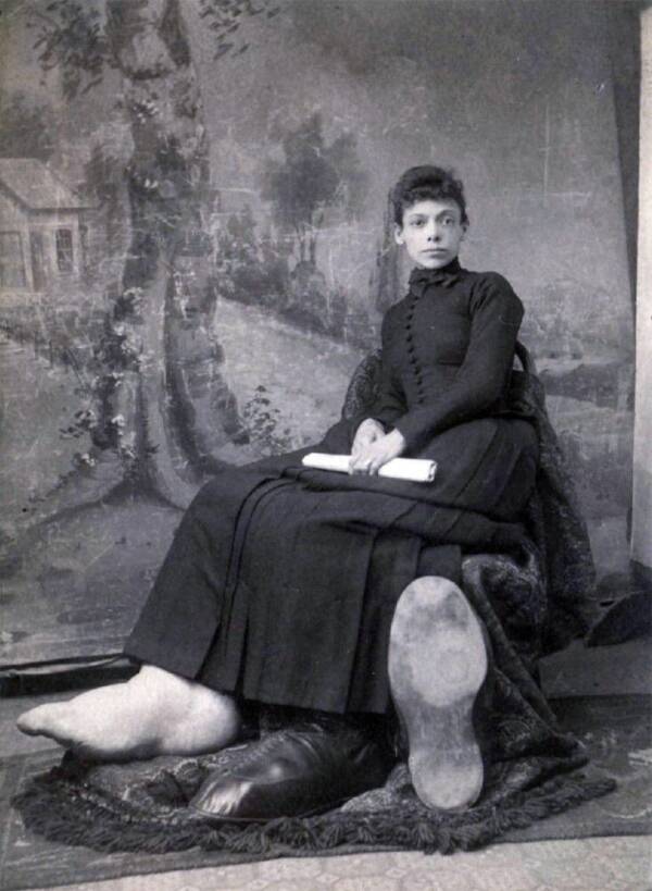 Fanny Mills - Cô gái chân to Ohio, người được mệnh danh là có đôi bàn chân to nhất Trái Đất! - Ảnh 5.
