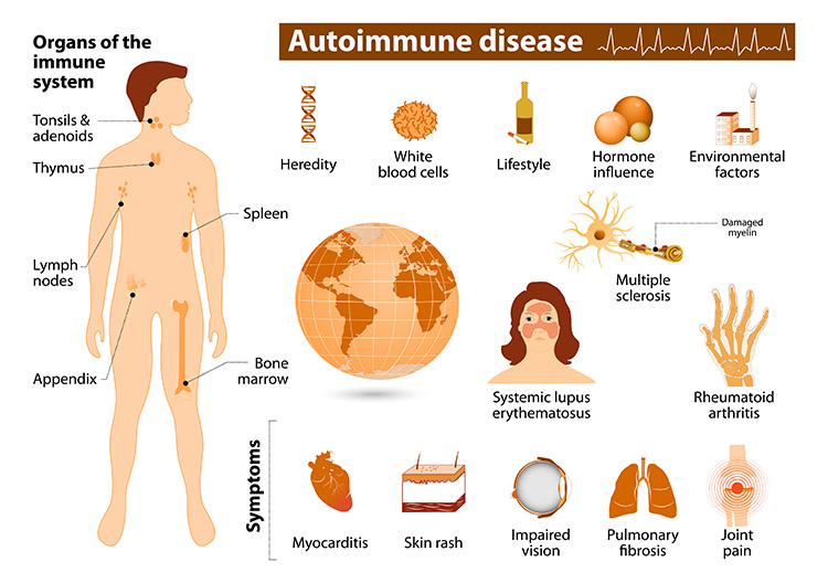 autoimmune_disease.jpg