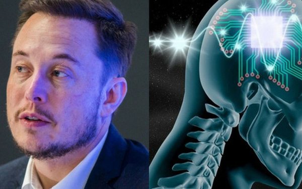 Công ty của Elon Musk chuẩn bị cấy ghép chip vào não người để &quot;chế tạo&quot; siêu nhân - Ảnh 1.