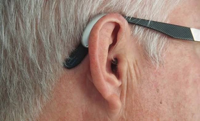 Medical students implant bluetooth devices in their ears to copy - Photo 1.