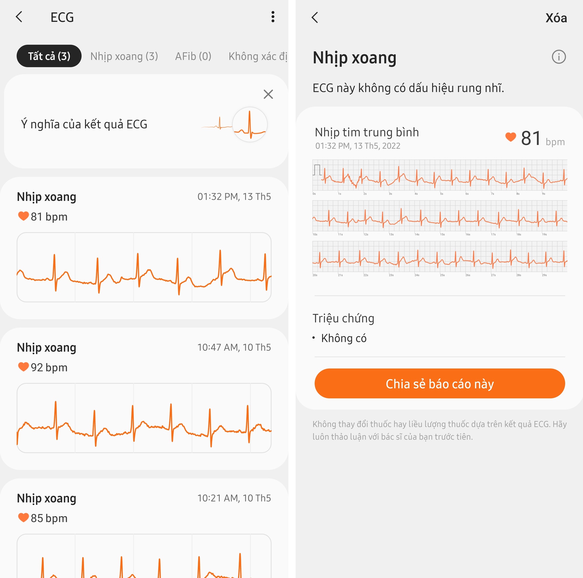 Electrocardiogram, blood pressure - Photo 6.