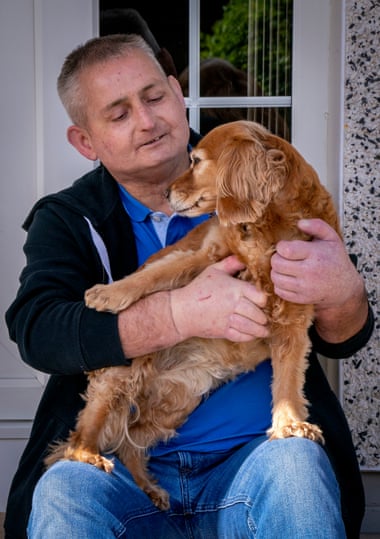 30 surgeons in 12 hours helped the man with a new pair of hands - Photo 8.