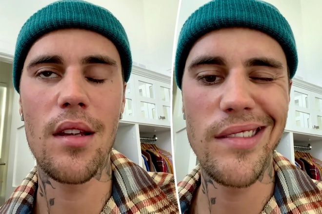 Justin Bieber bị liệt mặt vì một hội chứng tưởng lạ mà quen, đa số chúng ta  cũng nhiễm virus như anh ấy