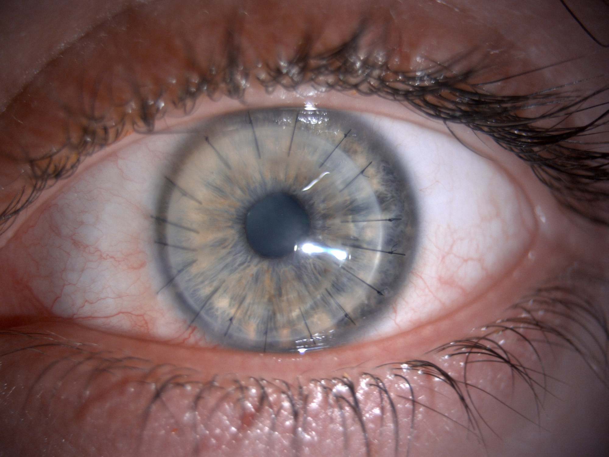 Sử dụng da heo trong chế tạo giác mạc cấy ghép, các nhà khoa học lấy lại được thị lực cho bệnh nhân khiếm thị - Ảnh 3.