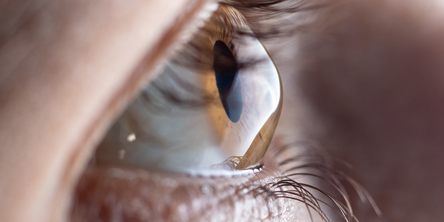Sử dụng da heo trong chế tạo giác mạc cấy ghép, các nhà khoa học lấy lại được thị lực cho bệnh nhân khiếm thị - Ảnh 1.