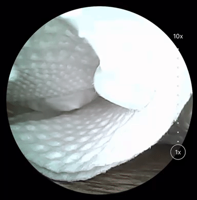 Dùng thử ngoáy tai gắn camera Xiaomi Bebird R1: Rẻ mà "ngon", dùng tiện, ngoáy sạch, kèm cả nhạc du dương- Ảnh 6.