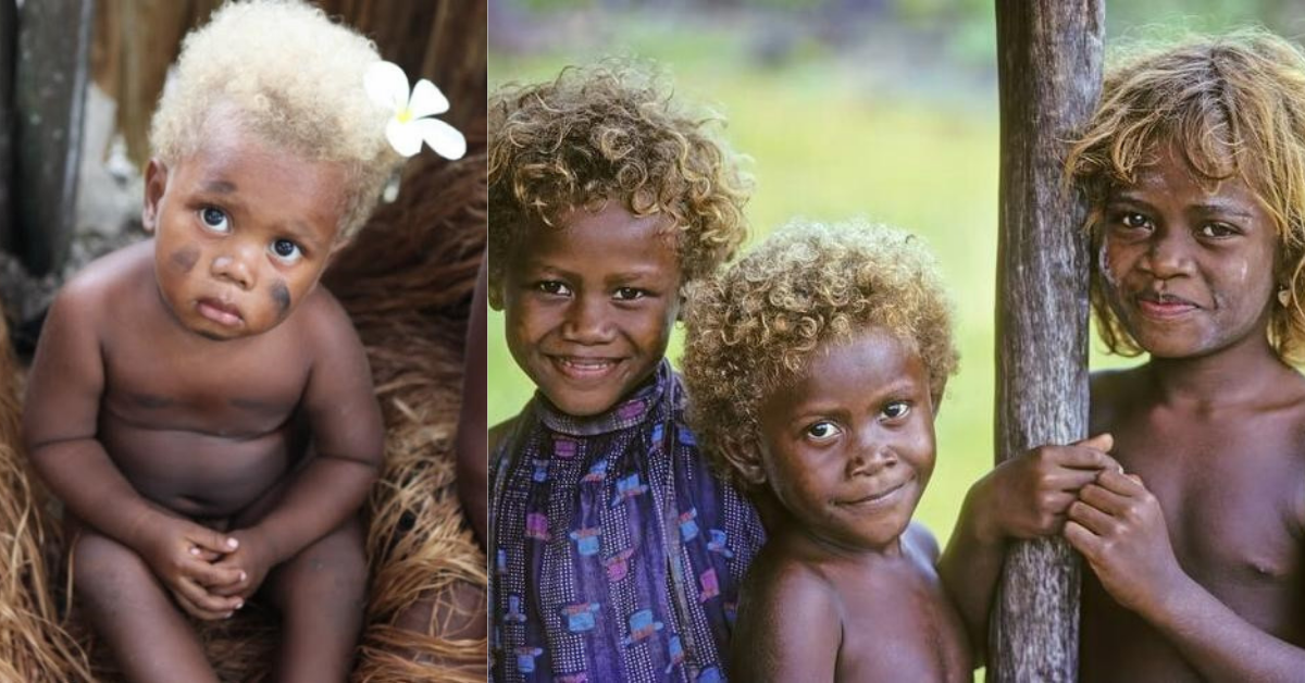 Tại sao lại có những người da đen sở hữu mái tóc vàng tự nhiên? - Ảnh 3.