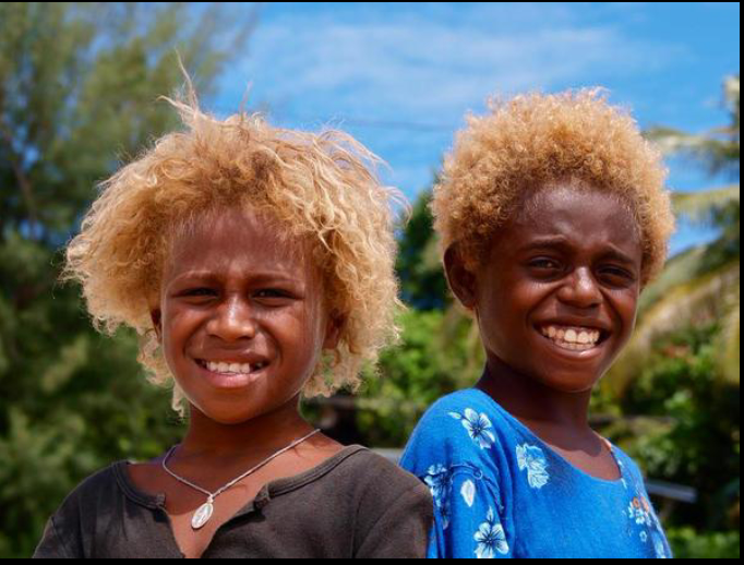 Tại sao lại có những người da đen sở hữu mái tóc vàng tự nhiên? - Ảnh 2.