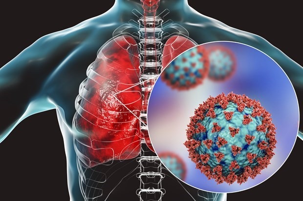 Tìm thấy dấu vết của virus SARS-CoV-2 ở hơn 80 vị trí khác nhau trong cơ thể, từ não và tim đến mắt - Ảnh 2.